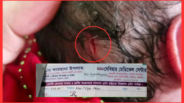 সিজারিয়ানের সময় নবজাতকের মাথা কেটে ফেলল চিকিৎসক!