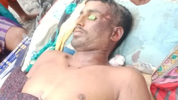 জামালগঞ্জে বজ্রপাতে এক কৃষকের মৃত্যু, আহত ৩