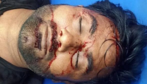 টেকনাফে সড়ক দুর্ঘটনায় নির্মাণ শ্রমিক দল নেতা জ্যাকি নিহত