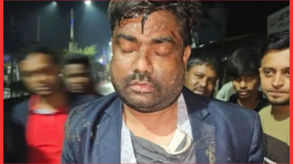 ফরিদপুরে অটোরিকশায় ছিনতাই চেষ্টা, জনতার হাতে আটক যুবক