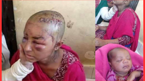 কন্যাসন্তান জন্ম দেওয়ার ‘অপরাধে’ স্বামীর নির্মম নির্যাতনের শিকার নারী