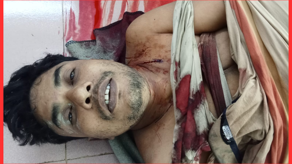 হাতিয়ায় দুই গ্রুপের সংঘর্ষে নিহত ৫, আহত অন্তত ৮