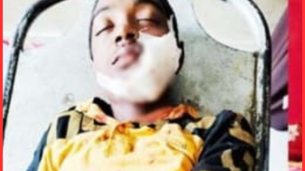 ঝিকরগাছায় মোটরসাইকেল দুর্ঘটনায় ছাত্রসহ আহত তিন