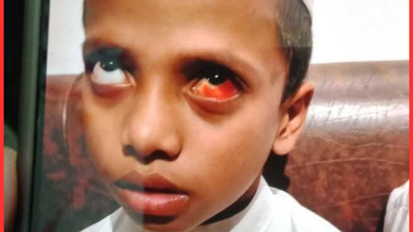 নোয়াখালীর একলাসপুরে মাদ্রাসায় শিশু নির্যাতনের অভিযোগে অভিযুক্ত গ্রেফতার