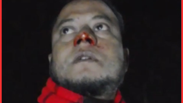 ব্রাহ্মণবাড়িয়া দৈনিক নবচেতনার জেলা প্রতিনিধি নাদিমের উপর হামলা