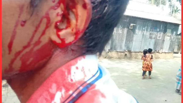 উলিপুরে জমি বিরোধে রক্তক্ষয়ী হামলা, গুরুতর আহত যুবক