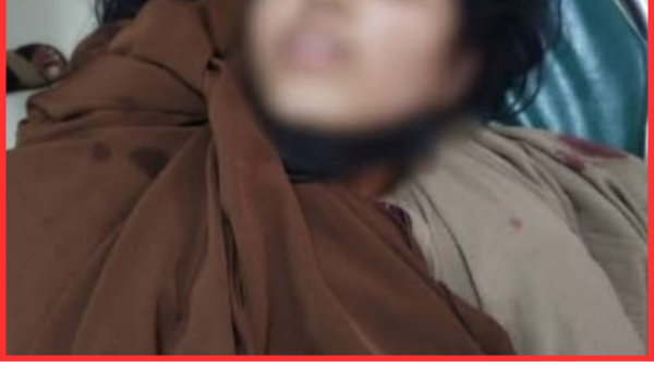 লোহাগাড়ায় সড়ক দুর্ঘটনায় বিশ্ববিদ্যালয় ছাত্রী গুরুতর আহত