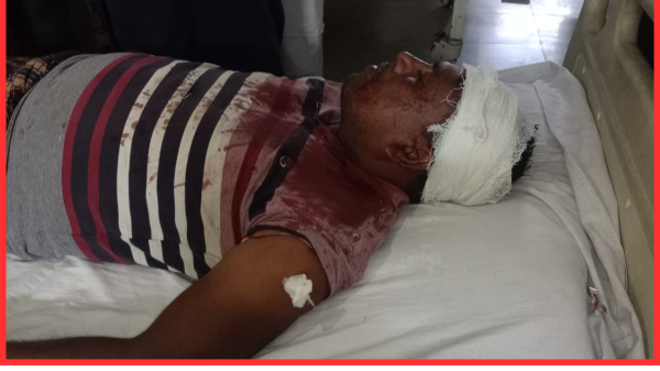 ভাঙ্গুড়ায় ব্যবসায়ীকে কুপিয়ে জখম, হাসপাতালে ভর্তি