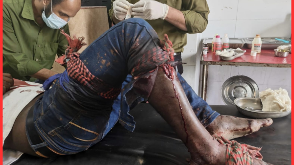 তালুকনগরে পারিবারিক বিরোধে জালাল ও পিন্টুর ওপর সন্ত্রাসী হামলা