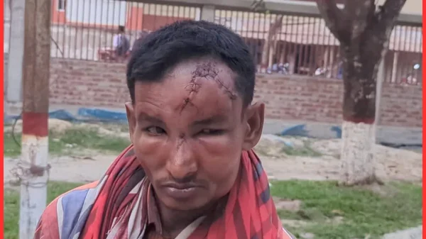 ধামইরহাটে খাবার চাওয়াকে কেন্দ্র করে মানসিক প্রতিবন্ধীর উপর হামলা, মাথায় ২০টি সেলাই—এক চোখ নষ্টের আশঙ্কা
