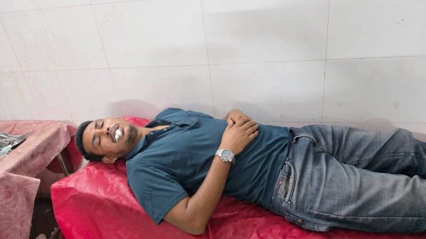 চারঘাটে হাত কাটার হুমকির পর সাংবাদিককে পেটালেন বিএনপি নেতাকর্মীরা