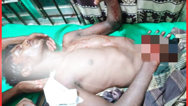 মাগুরার মহম্মদপুরে পরকীয়া সন্দেহে যুবককে কুপিয়ে কব্জি বিচ্ছিন্ন