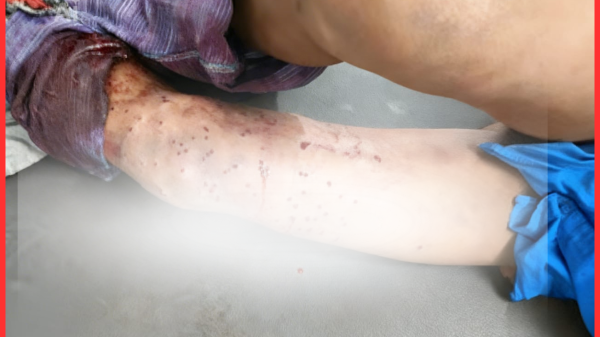 চট্টগ্রামে সন্ত্রাসী হামলা: আহত ৪, গ্রেপ্তার ৫