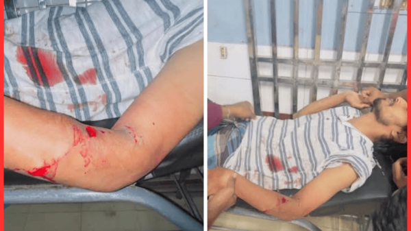 ব্রাহ্মণবাড়িয়ায় ছাত্রনেতার বাড়িতে গভীর রাতে সন্ত্রাসী হামলা, গুরুতর আহত শিমুল চৌধুরী